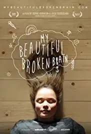 My Beautiful Broken Brain (2014)