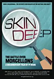 Skin Deep The Battle Over Morgellons (2019)
